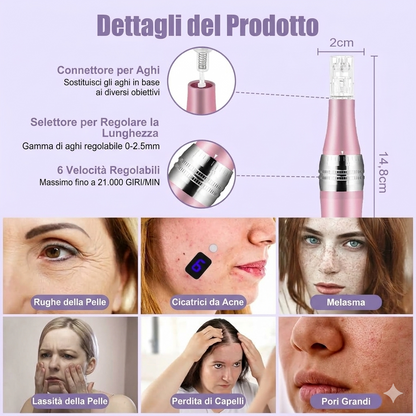 MAS PEN MICRONEEDLING