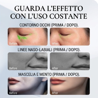 Dispositivo massaggiatore PRO + Crema al Collagene